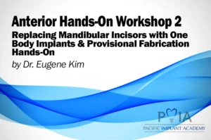 Anterior Hands-On Workshop 2