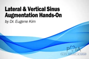 Lateral & Vertical Sinus Augmentation Hands On