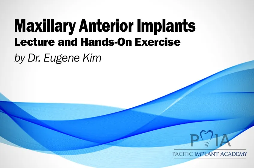 Maxillary Anterior Implants. Lecture and Hands On